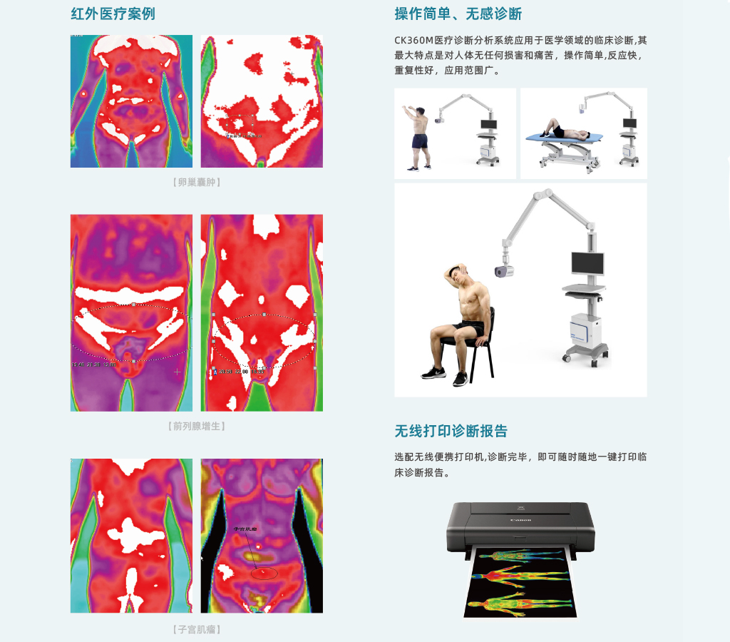 CK360-m醫療紅外熱像儀-颯特紅外4.jpg CK360-m醫療紅外熱像儀-颯特紅外4.jpg